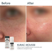 Braderm Kurac mousse Ніжна пінка для вмивання з Пребіотиками
