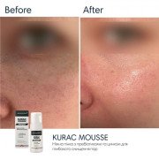 Braderm Kurac mousse Ніжна пінка для вмивання з Пребіотиками