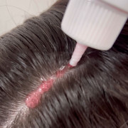 Derma Series Scalp Peeling пілінг-гель для глибокого очищення шкіри голови