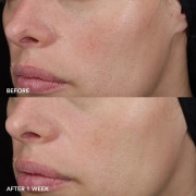 Image Skincare MD Barrier Repair Recovery Balm Ніжний відновлювальний бальзам