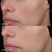 Image Skincare MD Barrier Repair Recovery Balm Нежный восстановительный бальзам