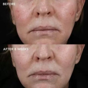 Image Skincare MD Biotech Longevity Creme Біоактивний крем клітинного оновлення