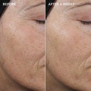 Image Skincare Ageless+ Retinol Pure Liquid Retinol 0.3% Концентрат чистого ретинола 0,3%