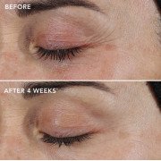 Image Skincare Ageless+ Repair Crème 0.3% Retinol Complex Восстанавливающий крем с ретиноловым комплексом 0,3%