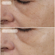 Image Skincare Ageless+ Retinol Overnight Masque 0.5% Retinol Complex Нічна відновлювальна маска з ретиноловим комплексом 0,5%