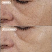 Image Skincare Ageless+ Retinol Overnight Masque 0.5% Retinol Complex Нічна відновлювальна маска з ретиноловим комплексом 0,5%